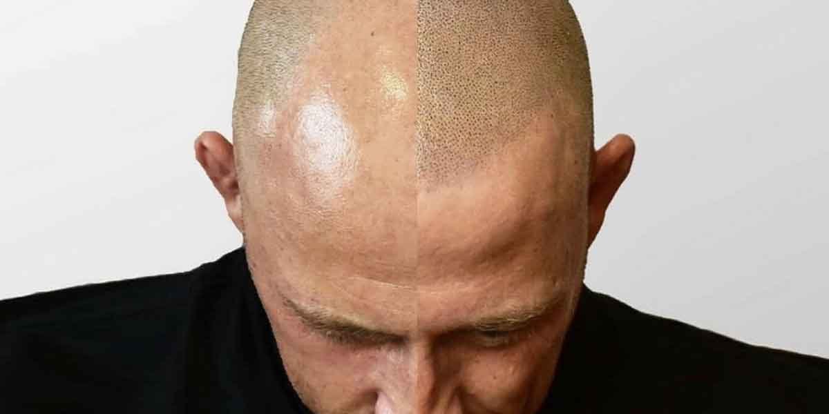 Common Misconceptions About Hair Tattoos