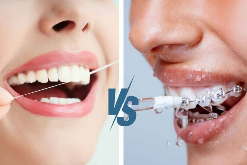 The benefits of water flossing technology