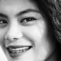 how-to-make-family-braces-planning-feel-less-stres-1