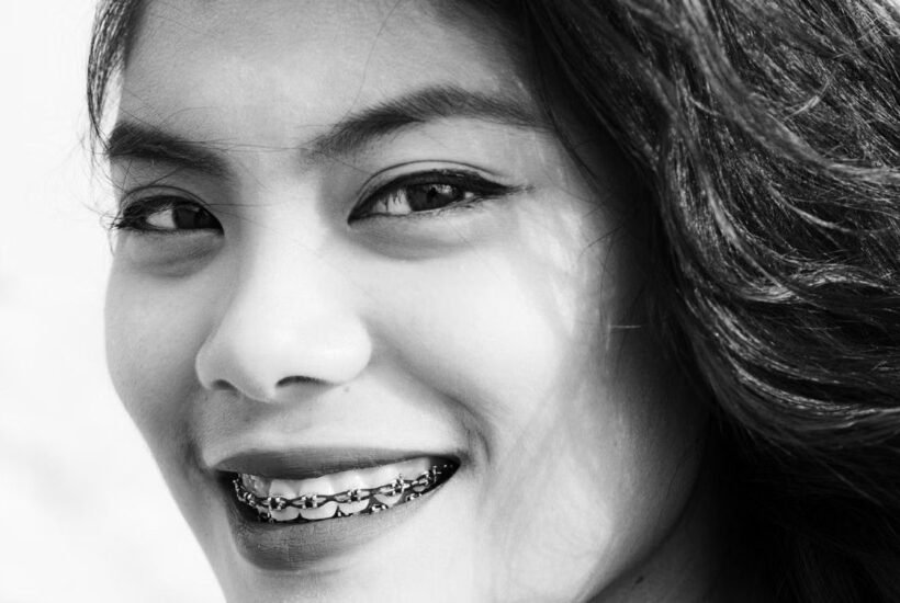 how-to-make-family-braces-planning-feel-less-stres-1