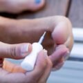 how-to-get-prescription-toenail-fungus-treatment-o-1